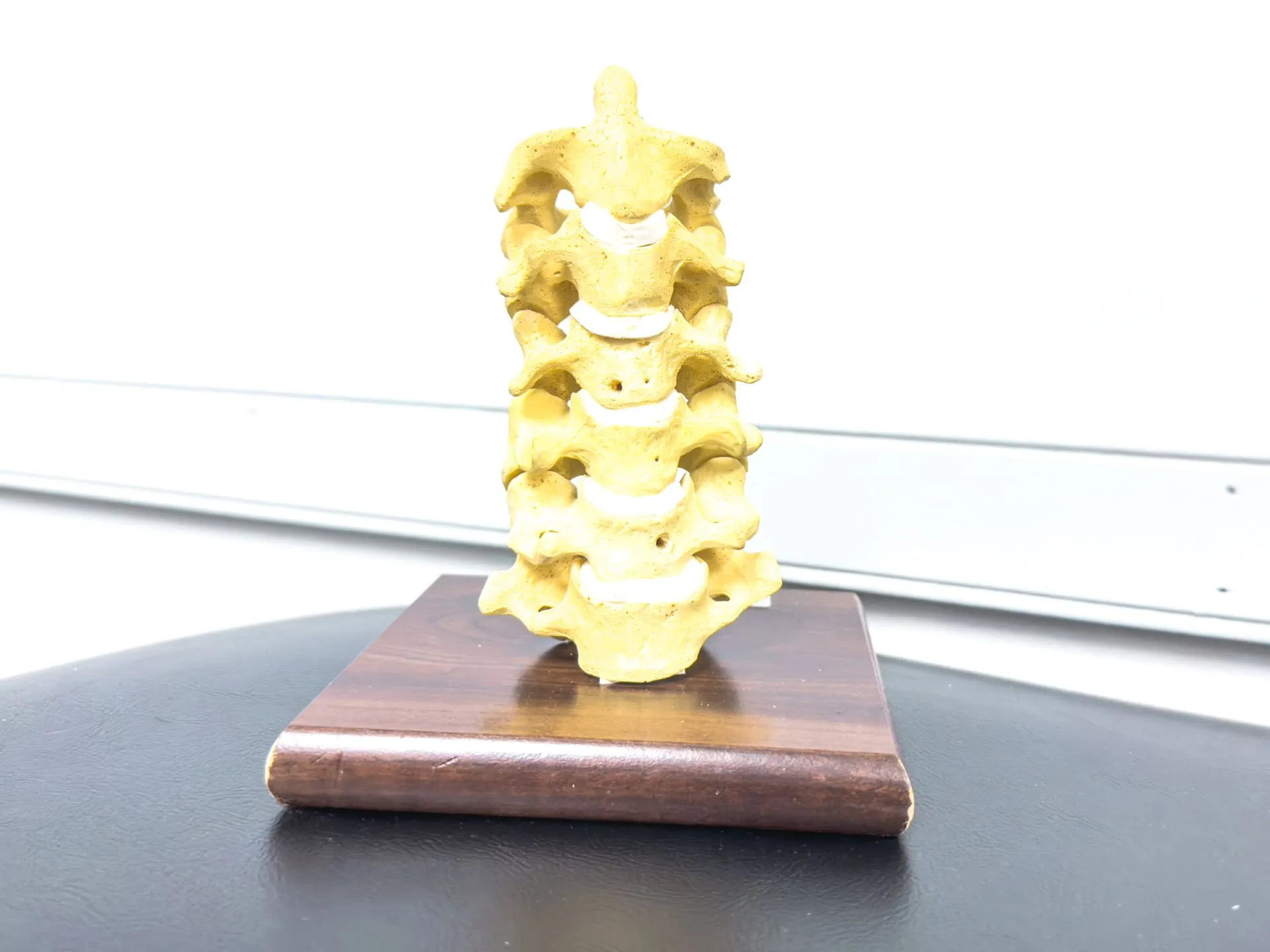 Cervical spine model used to explain neck-related symptoms at Crest Hill Clinic near Joliet, IL