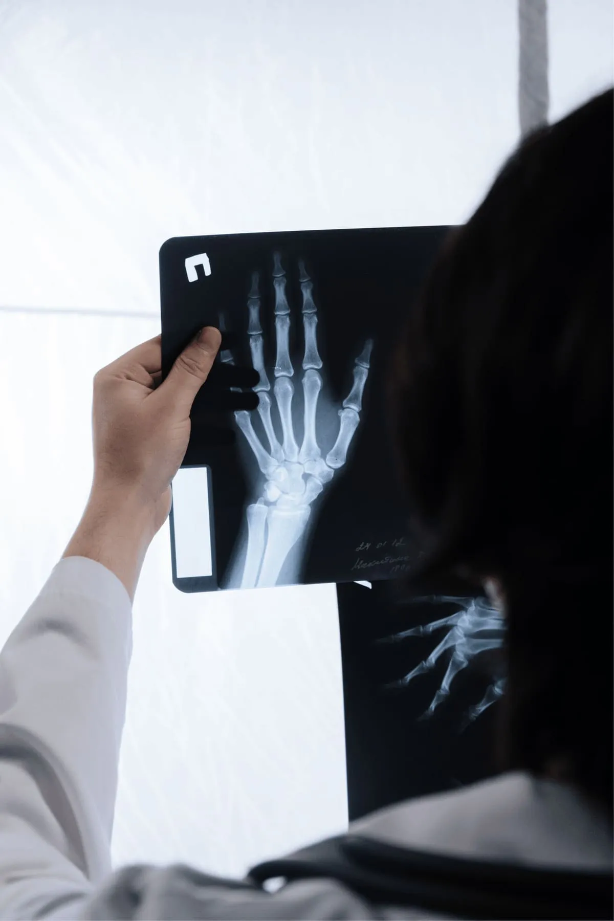 Hand and wrist x-ray relating to carpal tunnel syndrome at Crest Hill Clinic near Joliet, IL