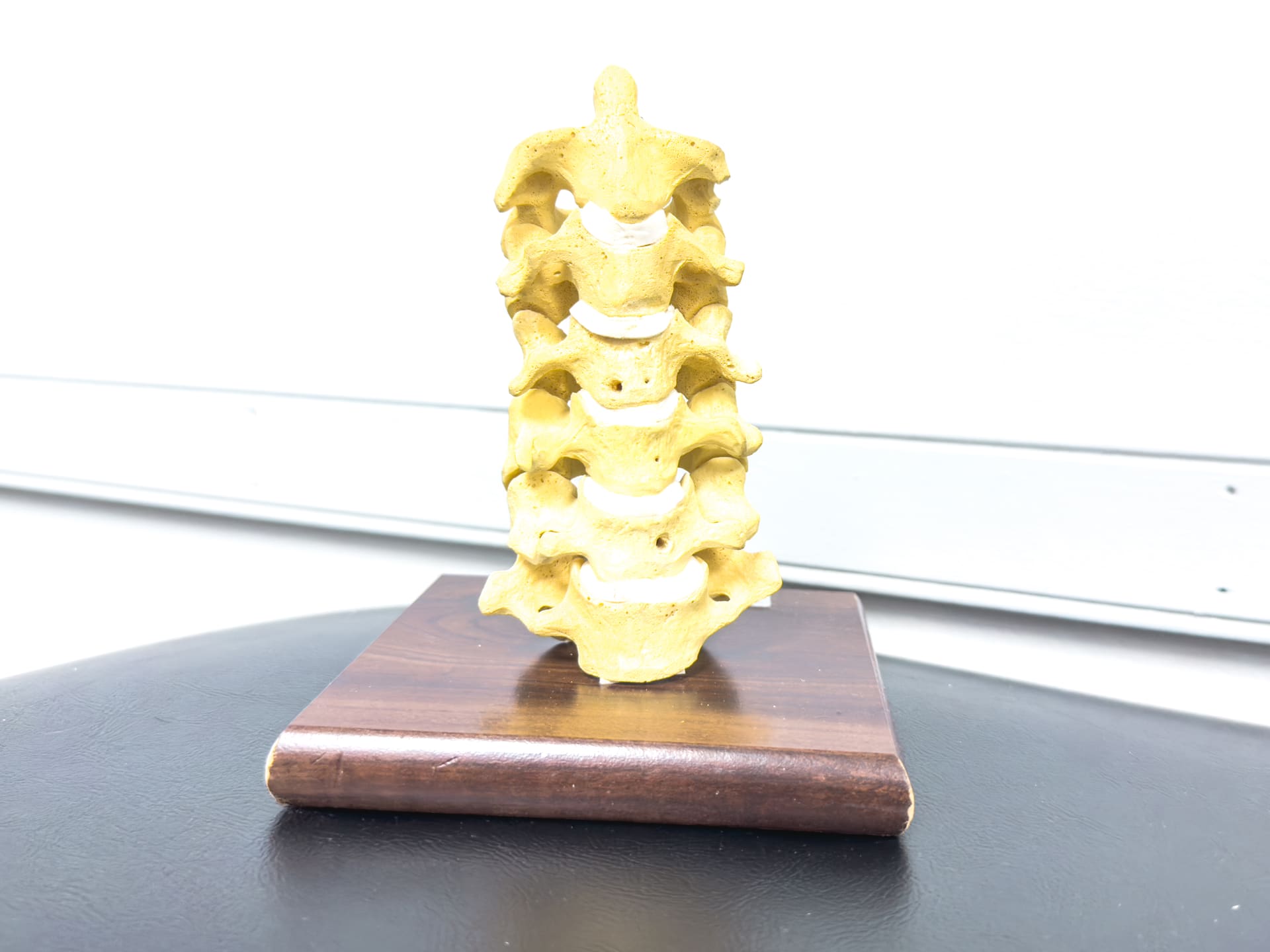 Cervical spine model used to explain neck-related symptoms at Crest Hill Clinic