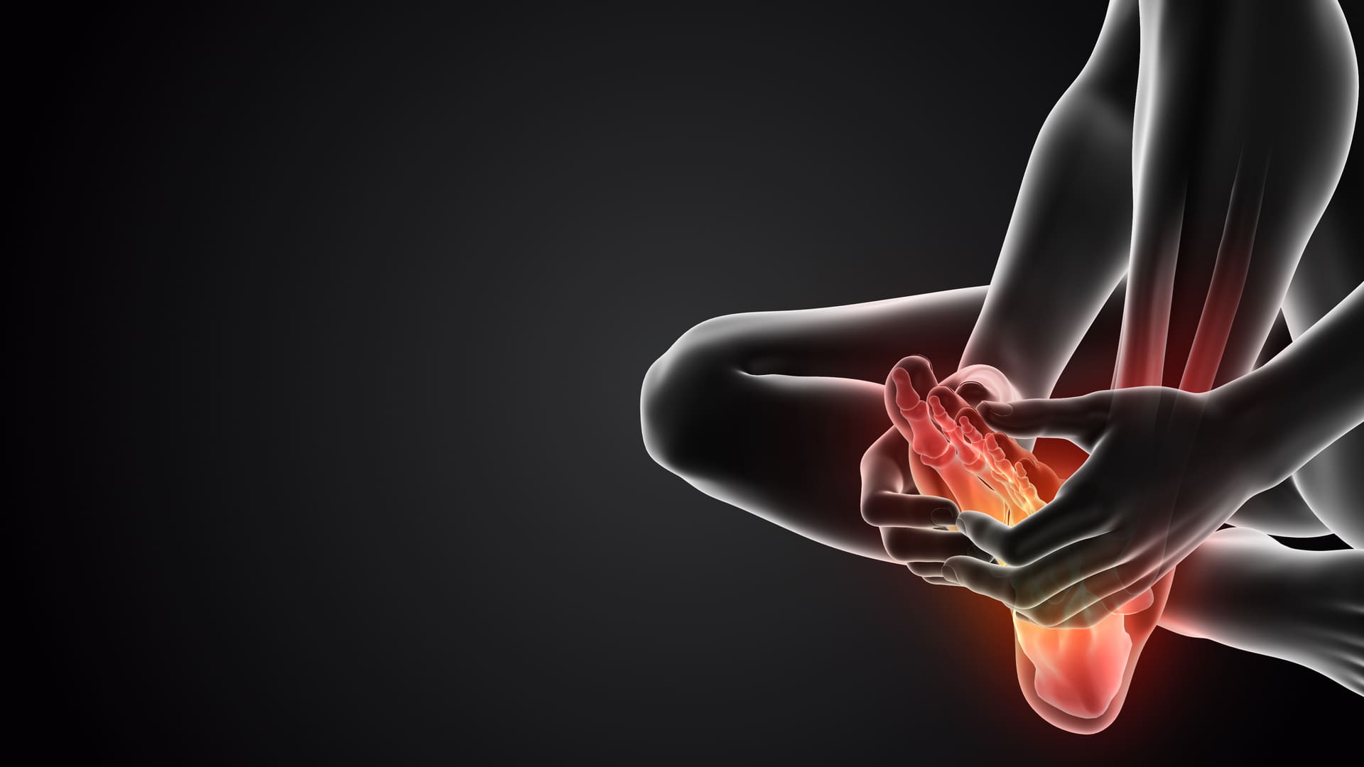 Nerve pain in the foot illustrating neuropathy