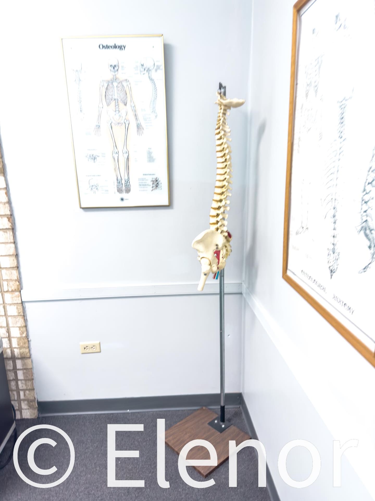 Spinal model illustrating sciatica and back pain at Crest Hill Clinic