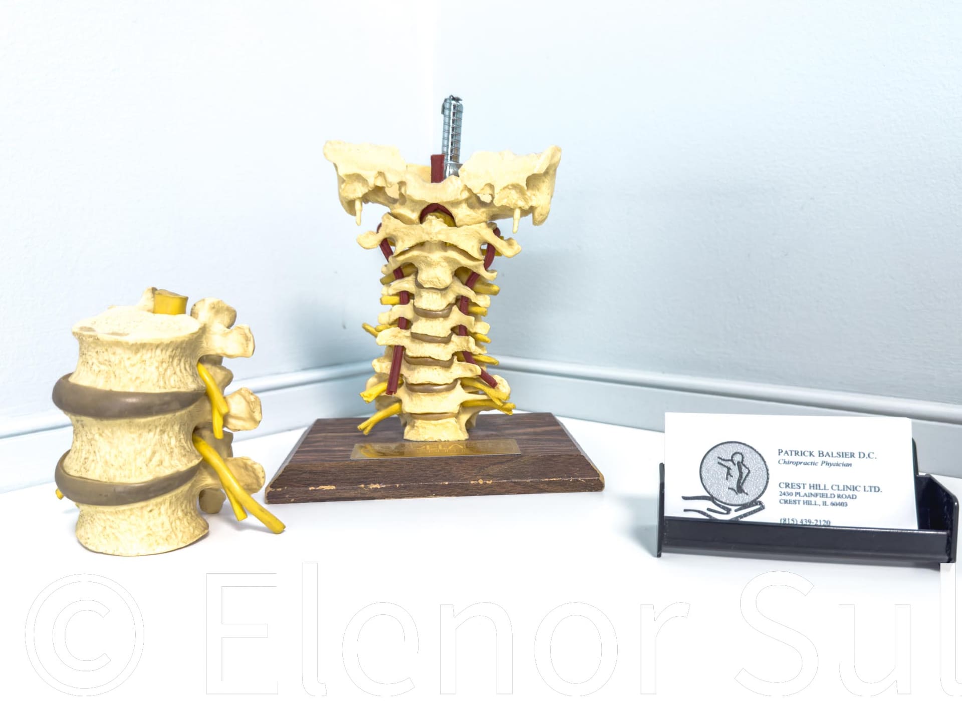 Spinal models used to explain neck pain and headaches at Crest Hill Clinic